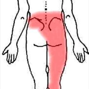 Pinched Sciatica - Proper Sciatica Exercises To Reduce Sciatica Pain