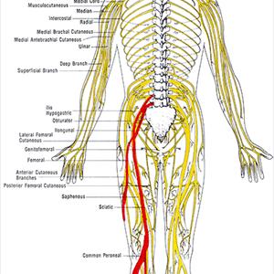 Yoga Poses For Sciatica - 3 Questions On Sciatica - Do You Know The "Right" Answers?