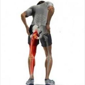 Sciatic Nerve Back Pain - Sciatica ... 3 Things You Must Know