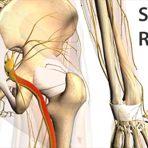 Back Sciatica Articles - Pinched Nerve Pain Causes And Relief With The Drx9000 Spinal Decompression System